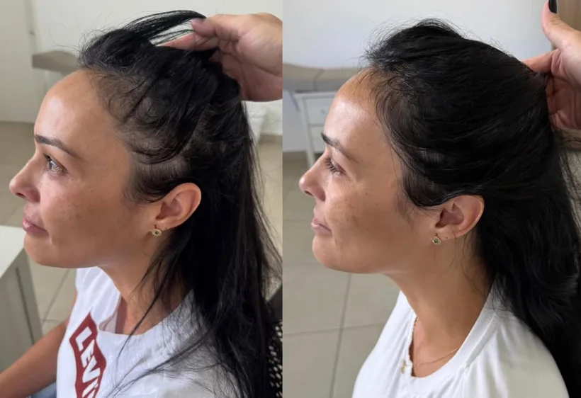 Foto da avaliação