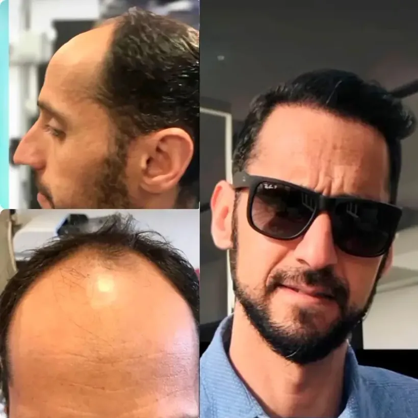 Foto da avaliação