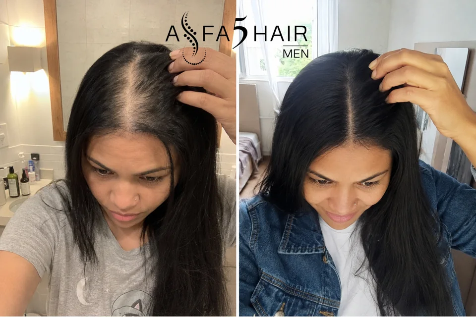 Antes e depois Alfa5Hair