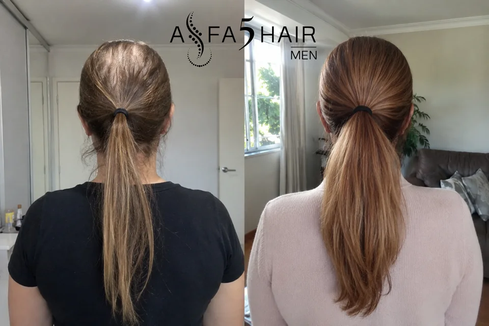 Antes e depois Alfa5Hair